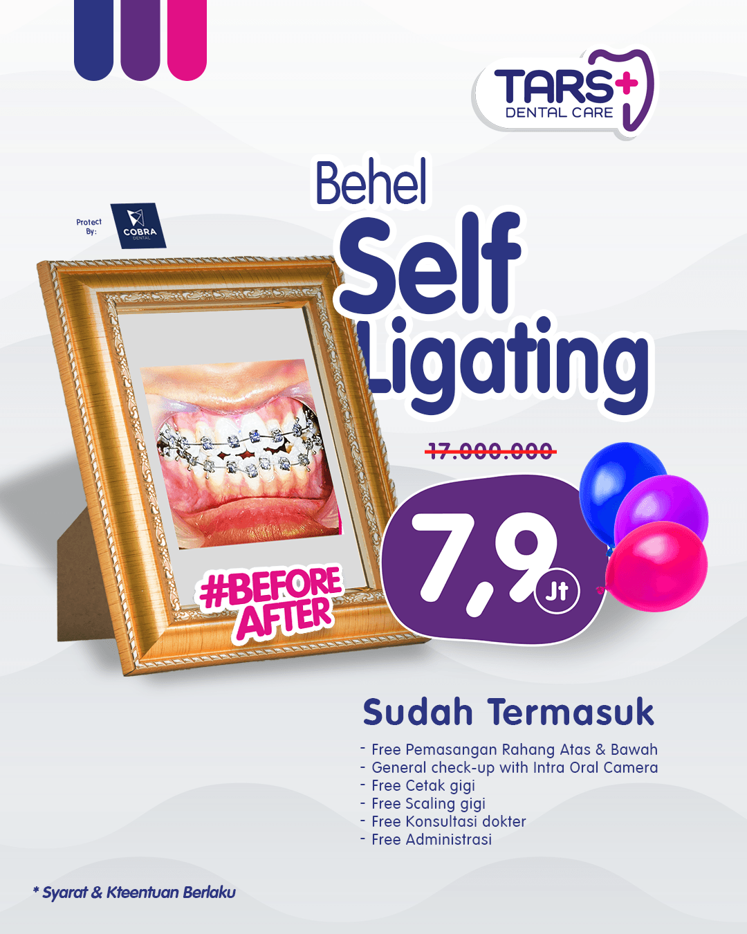 promo behel gigi self ligating