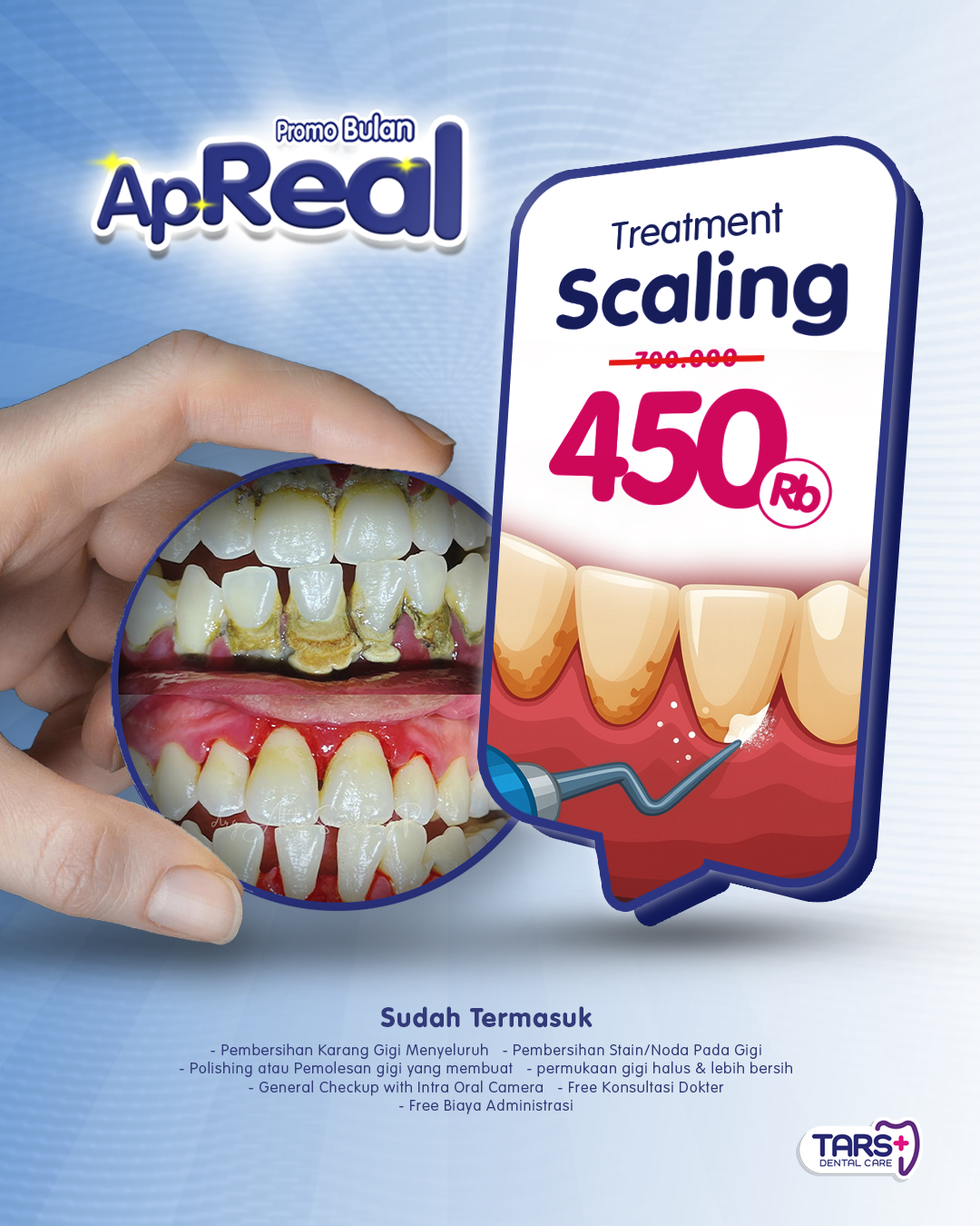 Promo April Scaling Gigi TARS Dental Care