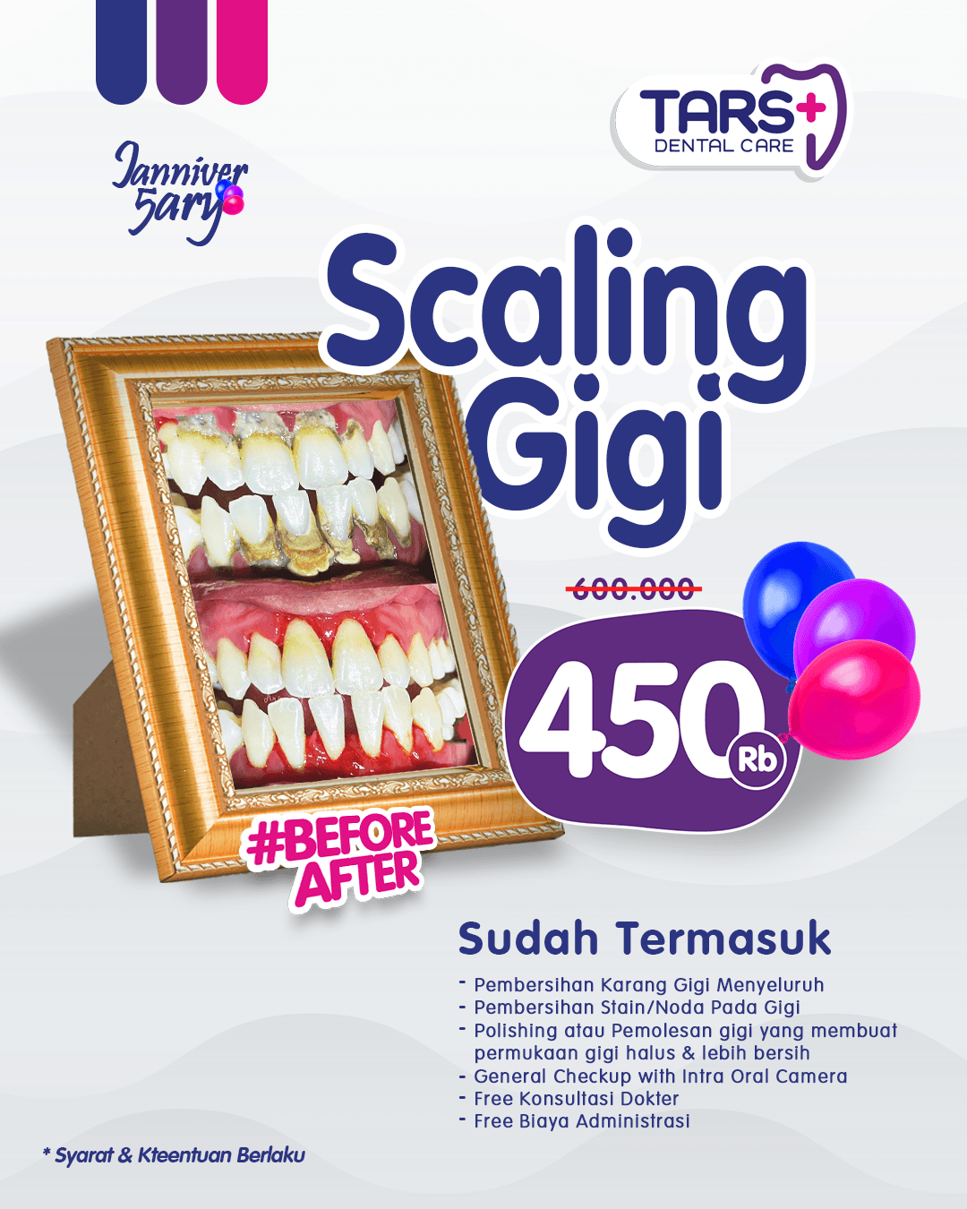 promo scaling gigi