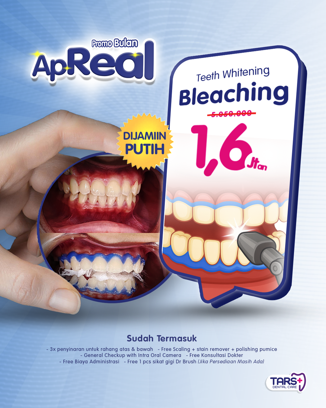 Promo April Bleaching Gigi TARS Dental Care