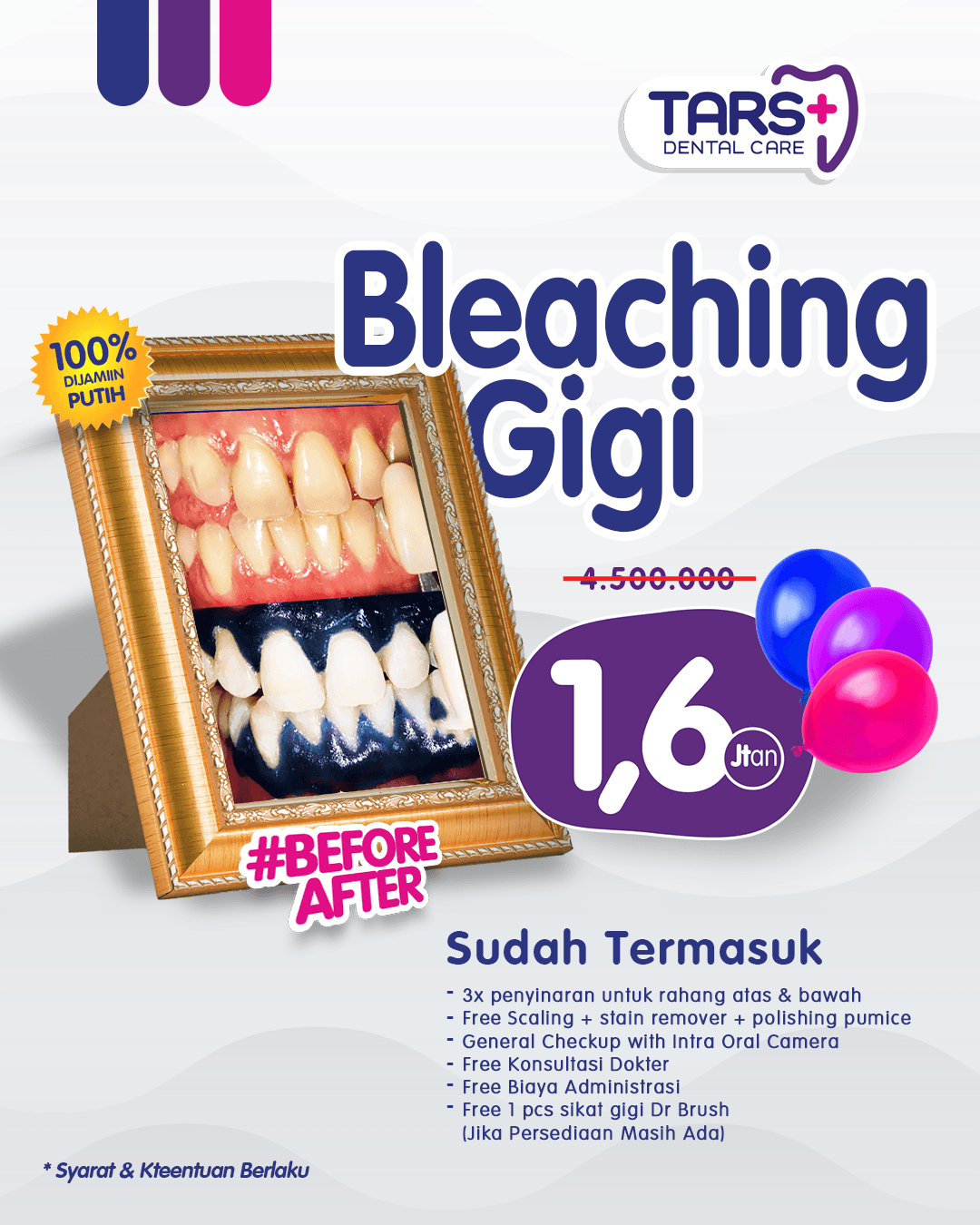 promo bleaching gigi