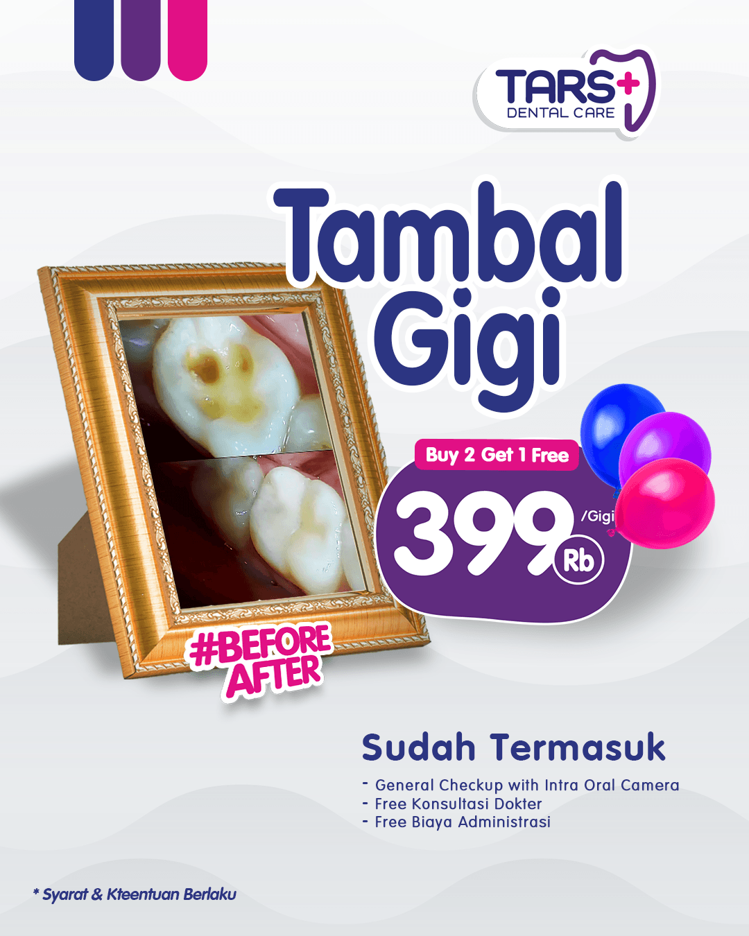promo tambal gigi