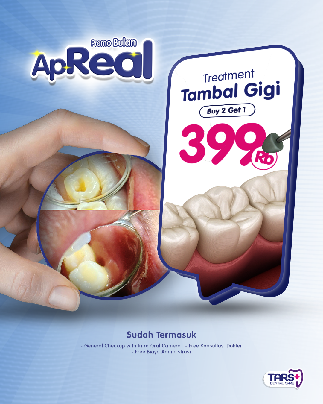 Promo April Tambal Gigi TARS Dental Care