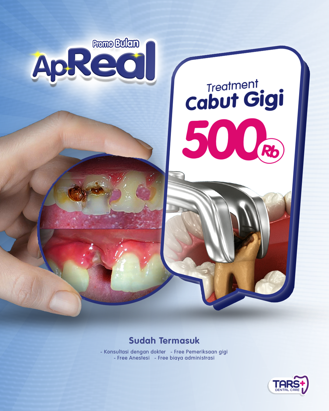 Promo April Cabut Gigi TARS Dental Care