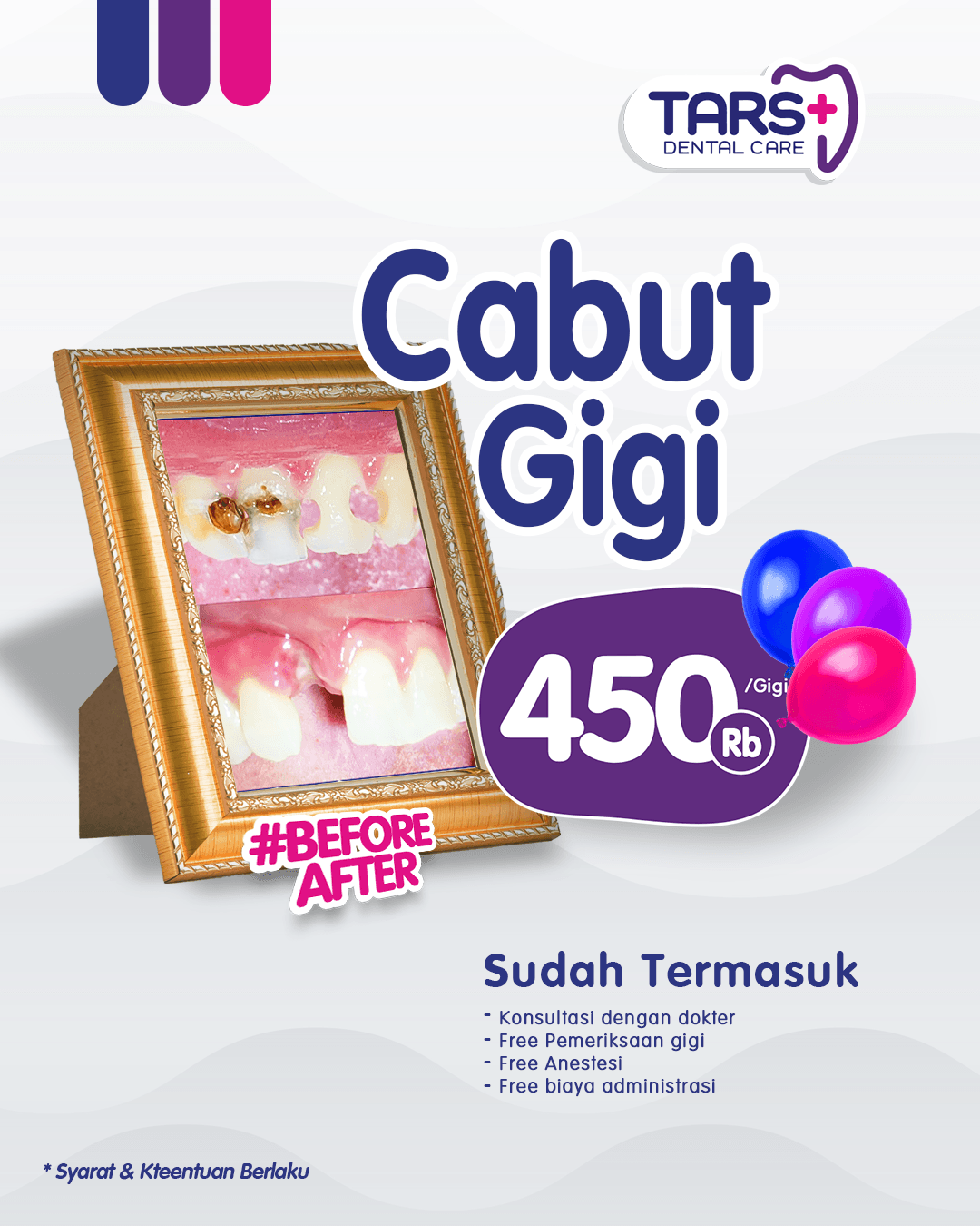 promo cabut gigi