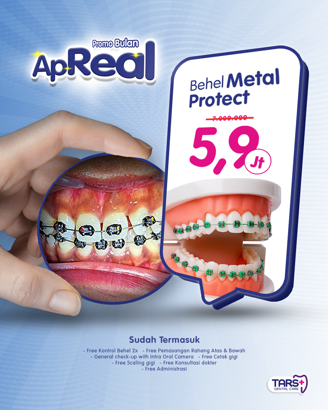 Promo April Behel Gigi Klinik TARS Dental Care