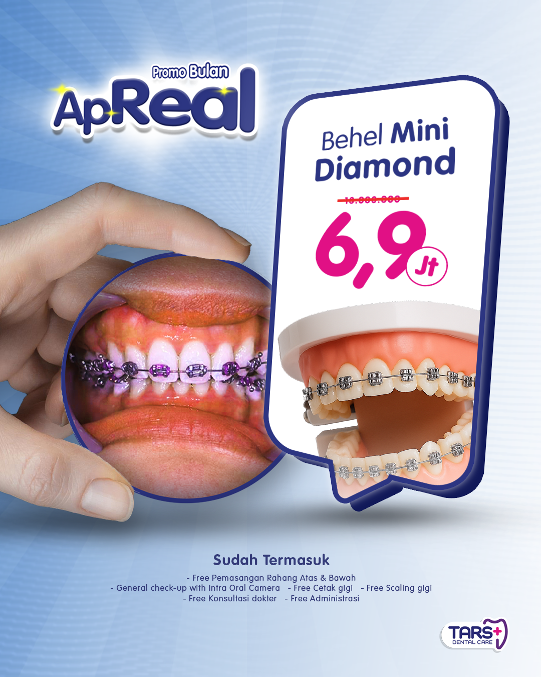 Promo April Behel Gigi mini Diamond Klinik TARS Dental Care
