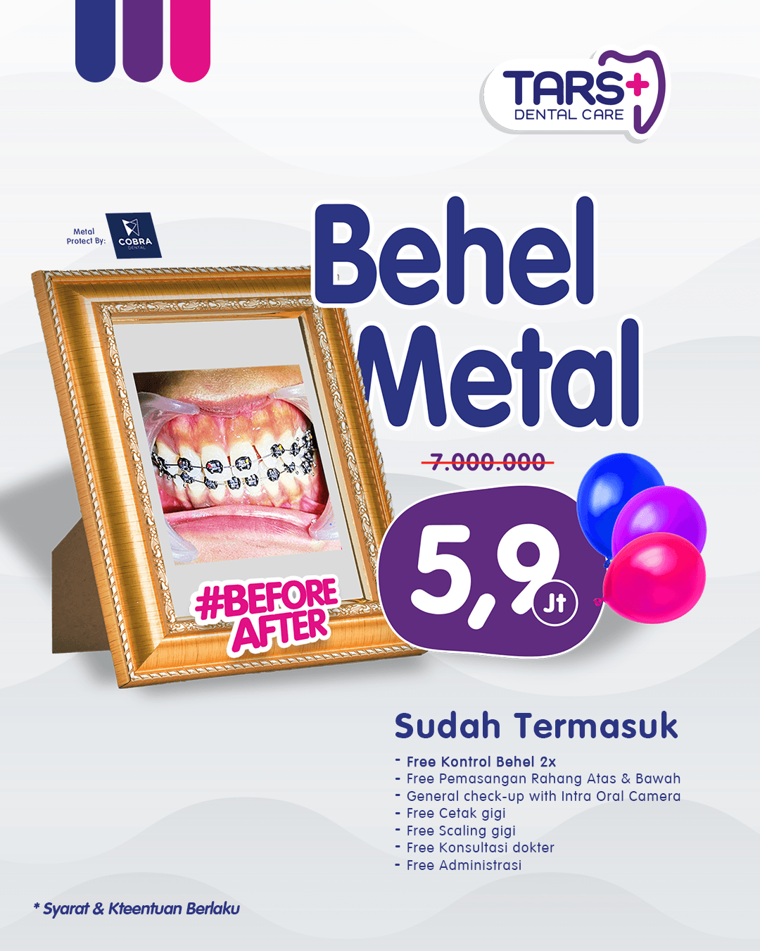 promo behel gigi
