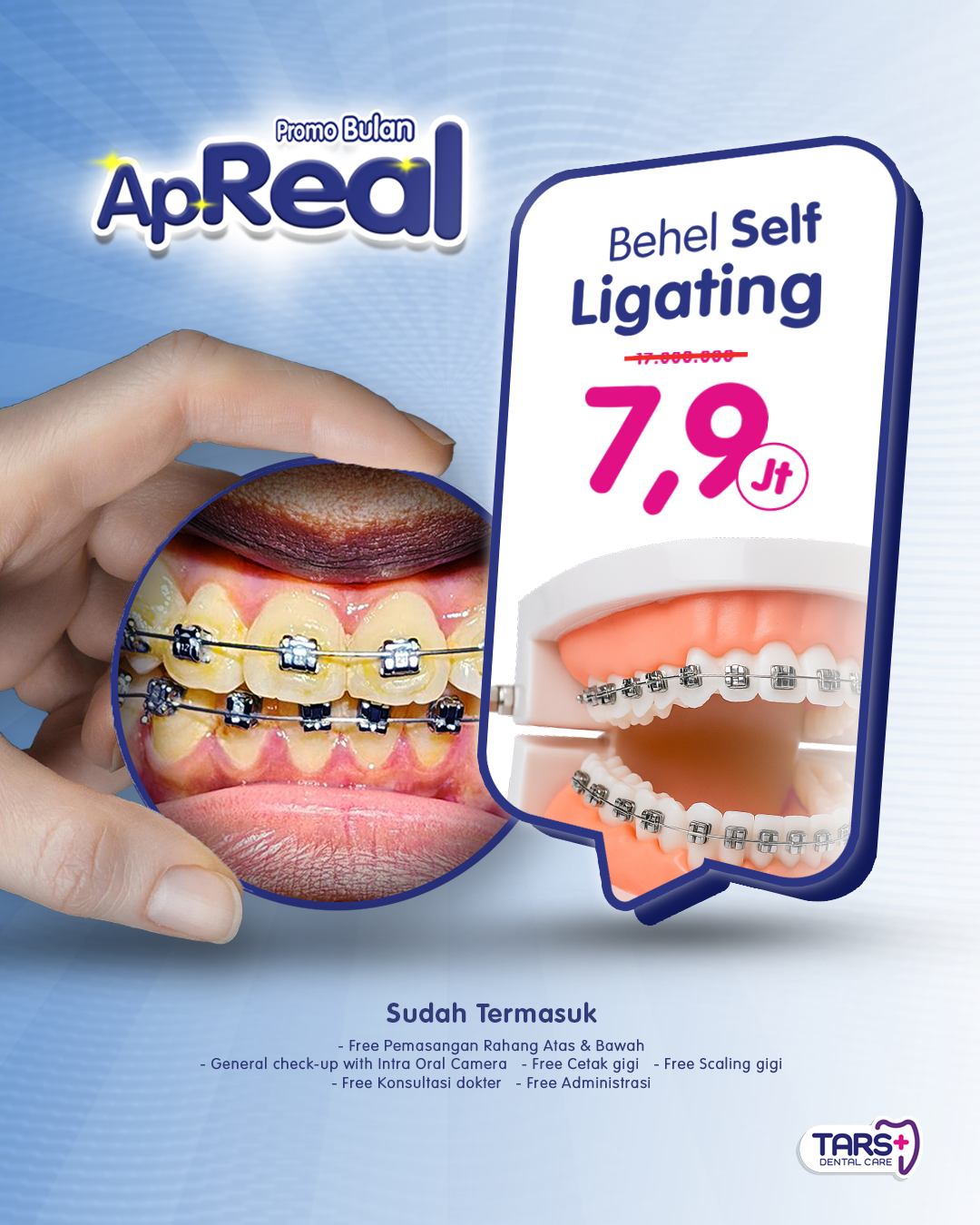 Promo April Behel Gigi Self Ligating Klinik TARS Dental Care