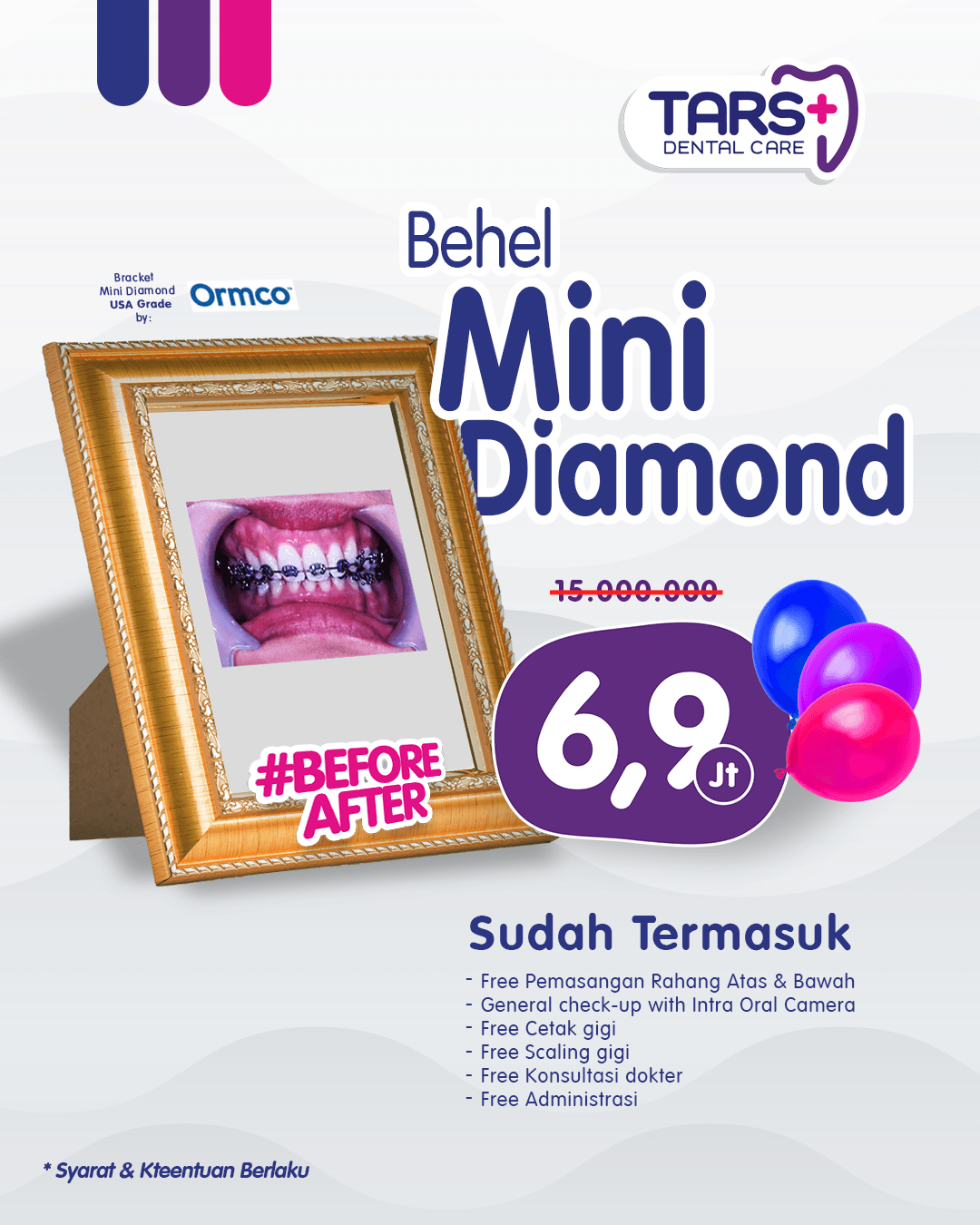 promo behel gigi mini diamond
