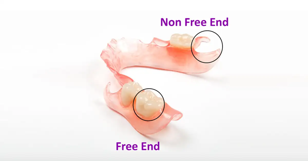 Mengenal 2 Jenis Gigi Palsu: Mana yang Cocok untuk Kamu?