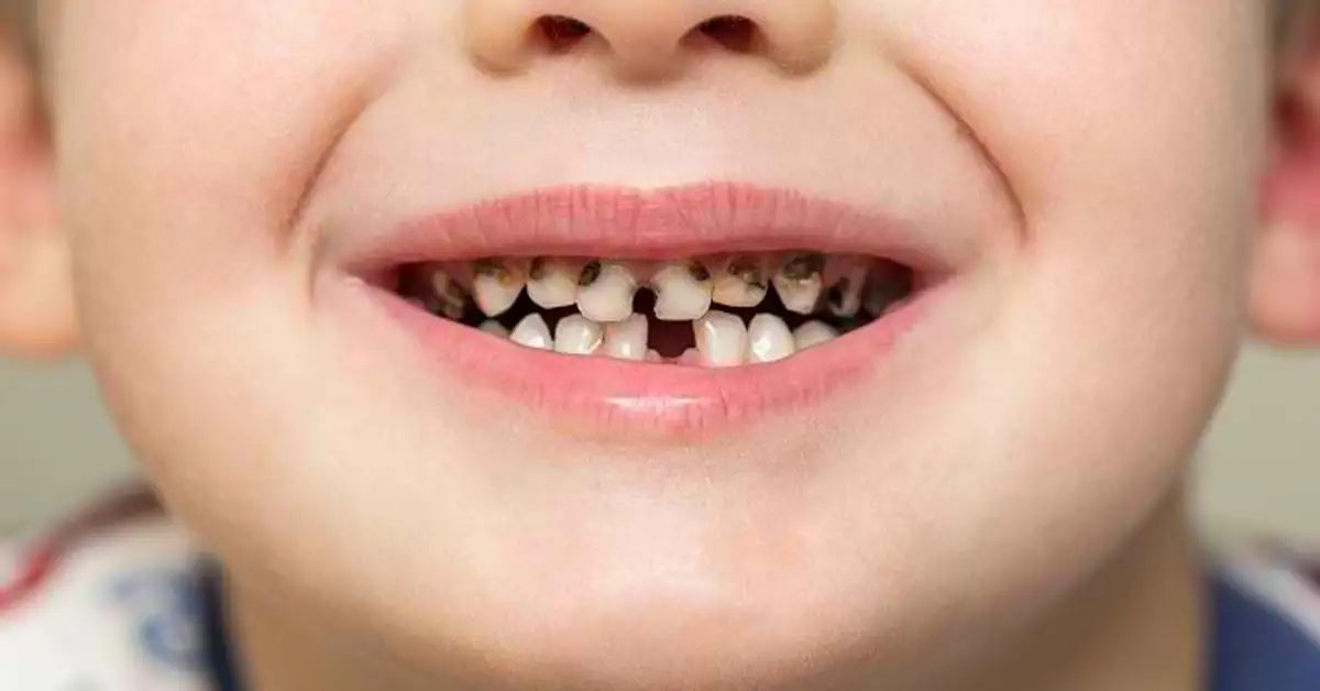 Kesehatan Gigi dan Mulut Anak: Panduan Lengkap untuk Orang Tua