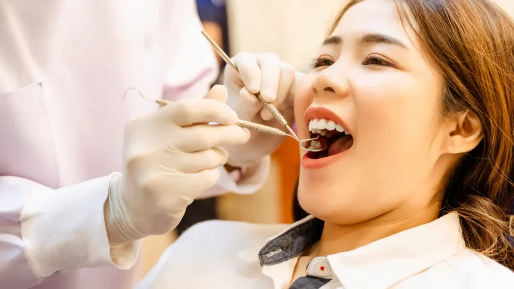 Bleaching Gigi Bleaching Gigi Tars Dental Care