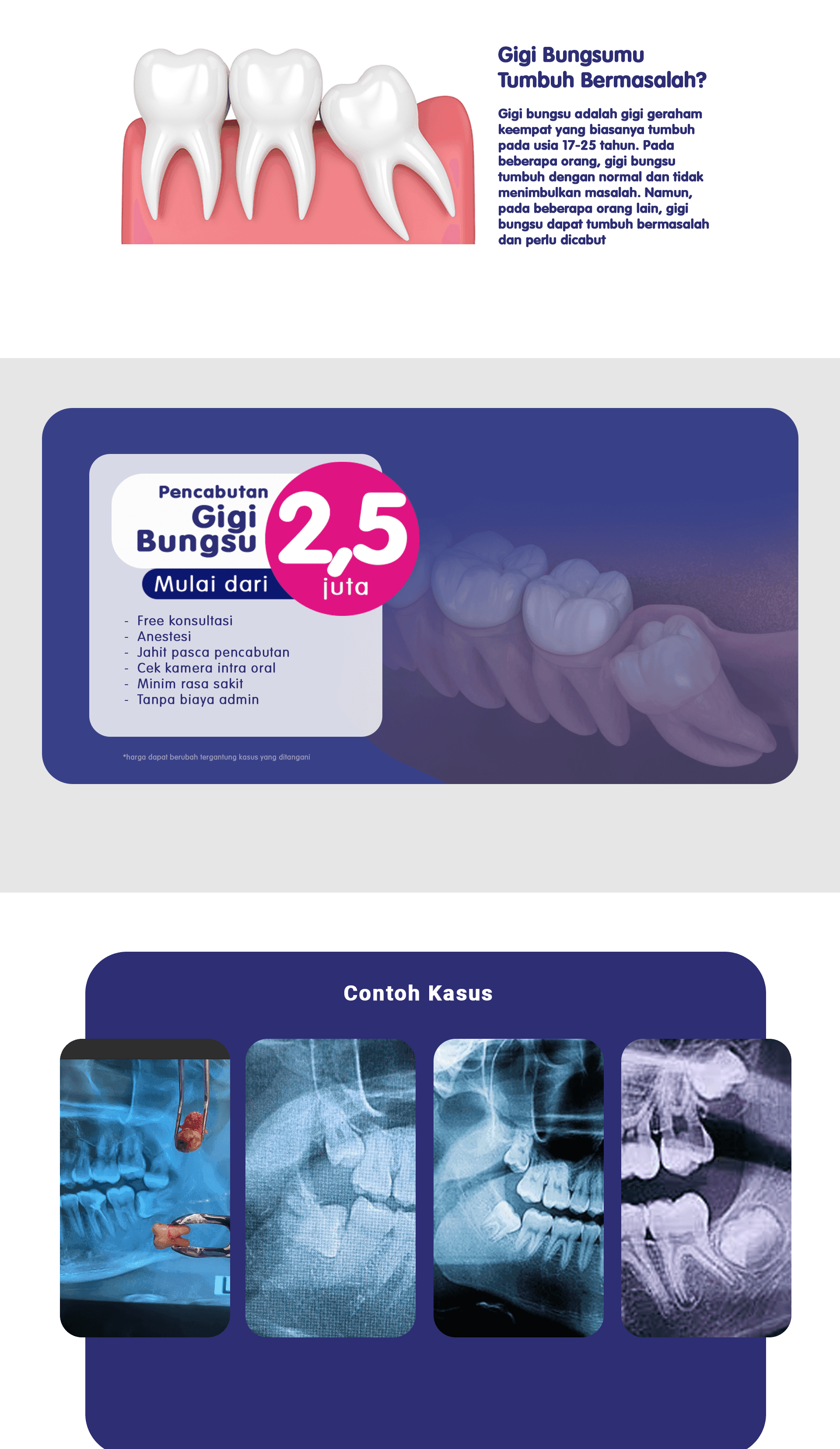 Gigi Bungsu - LP 2024