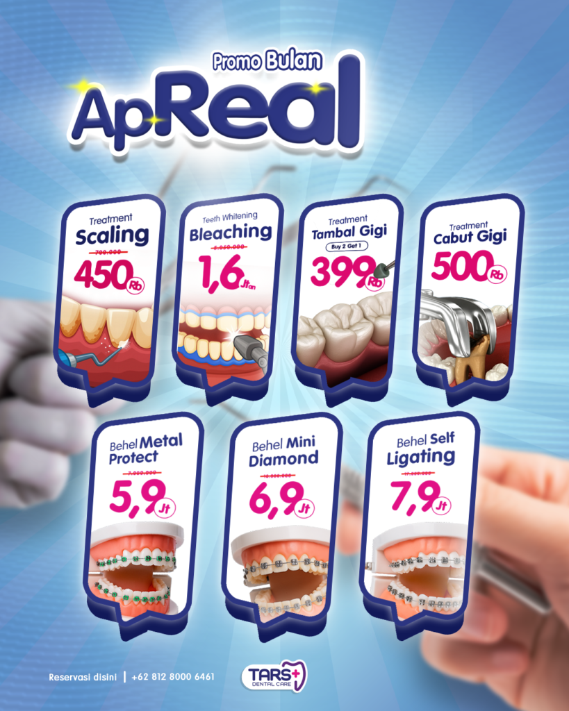 promo treatment gigi di klinik gigi tars dental