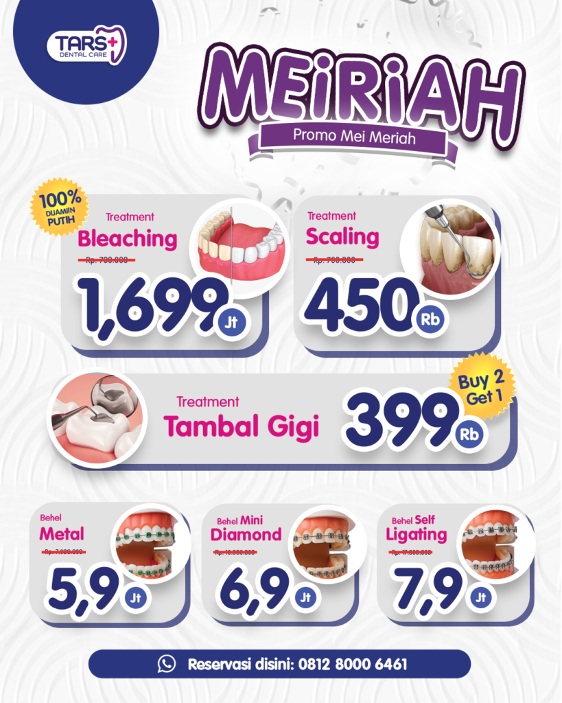 Promo Perawatan klinik gigi TARS Dental Care