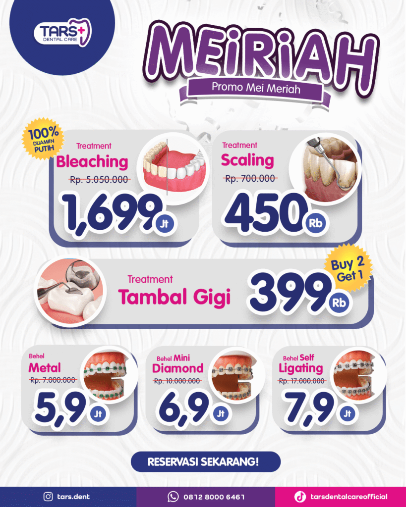 Promo Perawatan Gigi klinik gigi TARS Dental Care