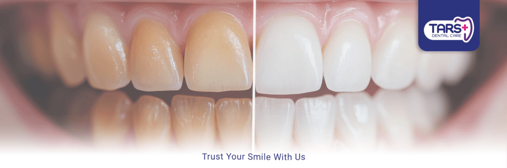 Bleaching Gigi - LP 2024