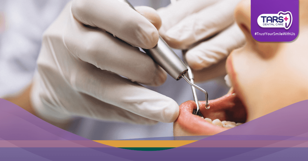 Mulut Kering Bikin Bau Mulut Ini Solusi dari Dokter Gigi!