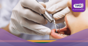 Mulut Kering Bikin Bau Mulut Ini Solusi dari Dokter Gigi!