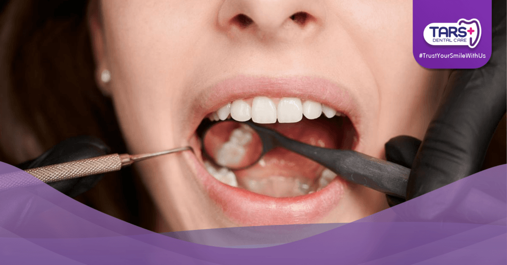 Apakah Cabut Gigi Bungsu Itu Sakit Ini yang Perlu Anda Tahu!