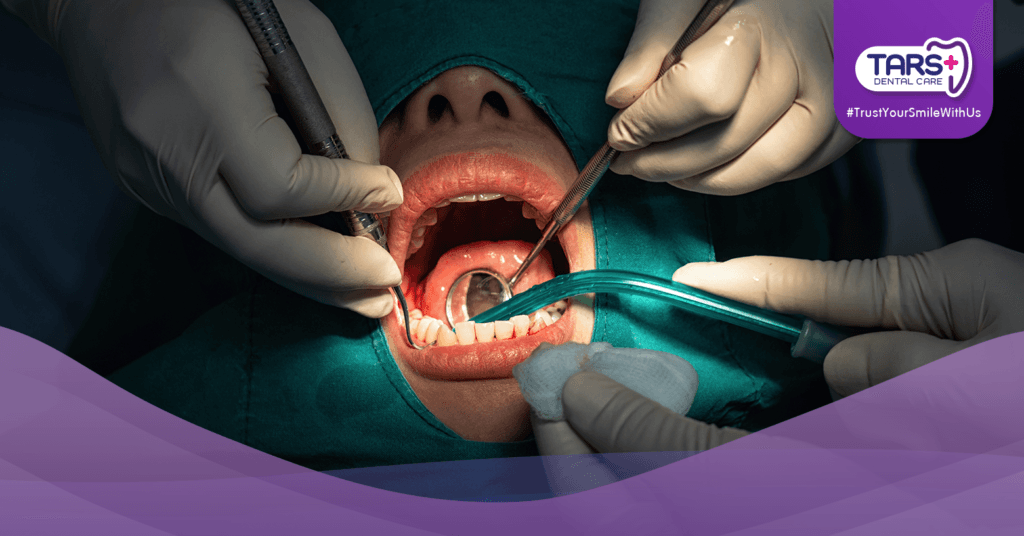 Cabut Gigi Bungsu? Tidak Perlu Takut, Ini Faktanya!