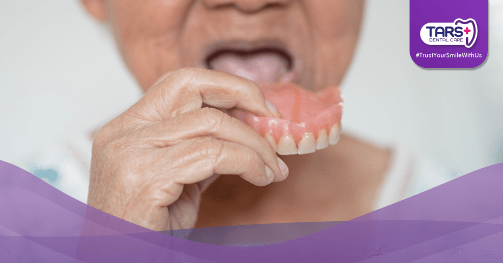 Gigi Tiruan vs Gigi Asli: Bisakah Terlihat Natural?