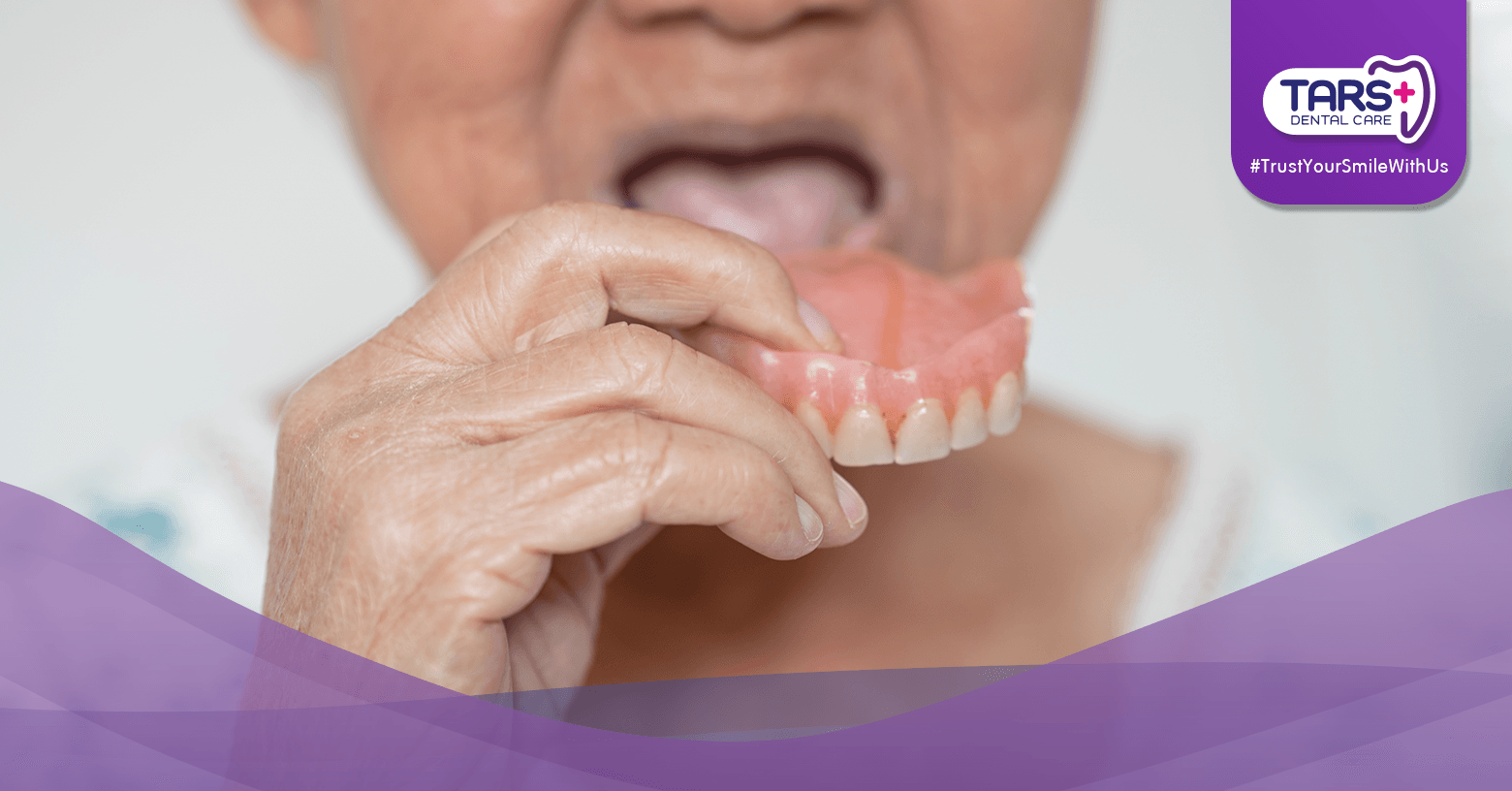 Gigi Tiruan vs Gigi Asli: Bisakah Terlihat Natural?