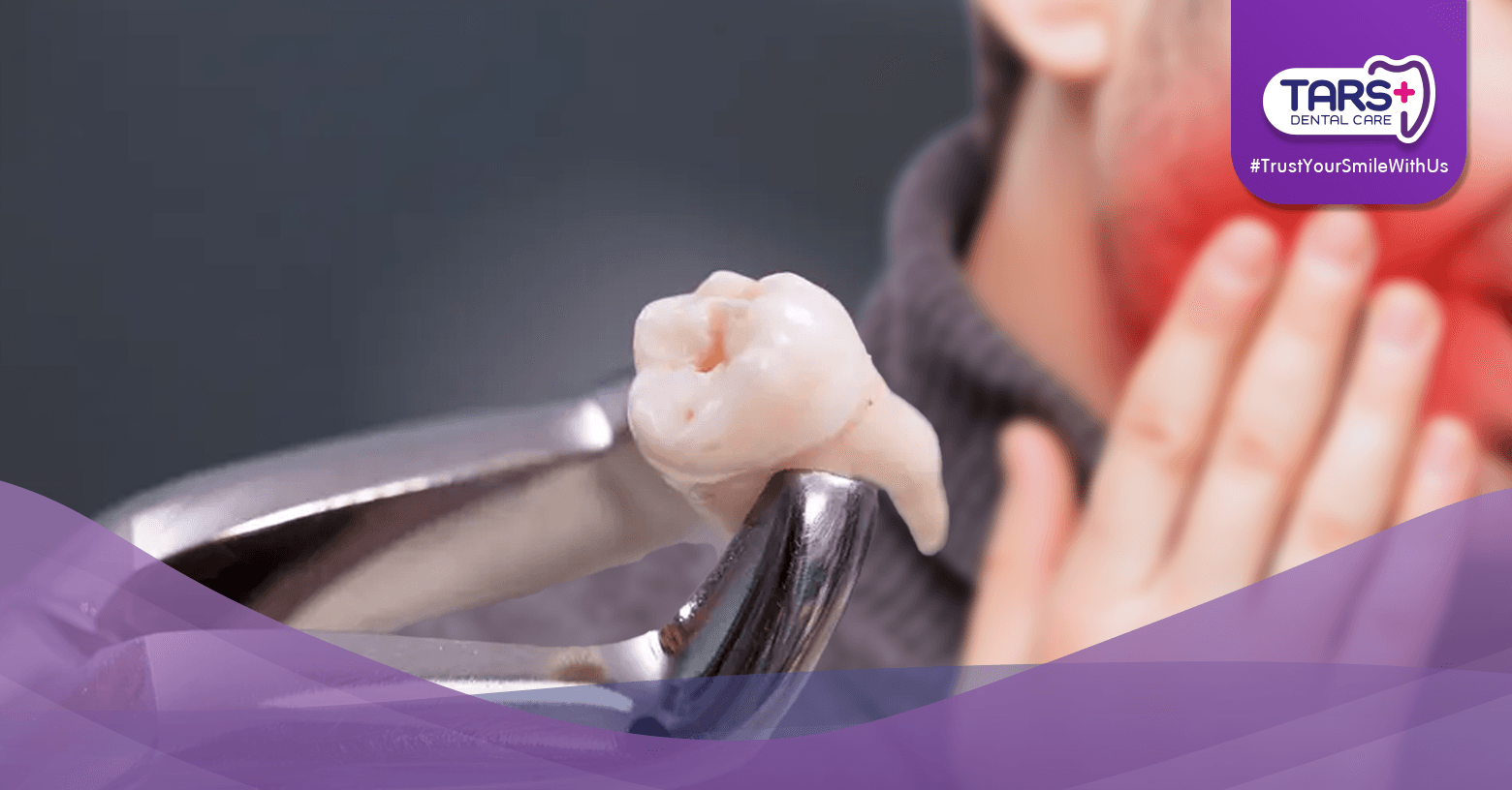 Cabut Gigi Bungsu Pipi Bisa Bengkak