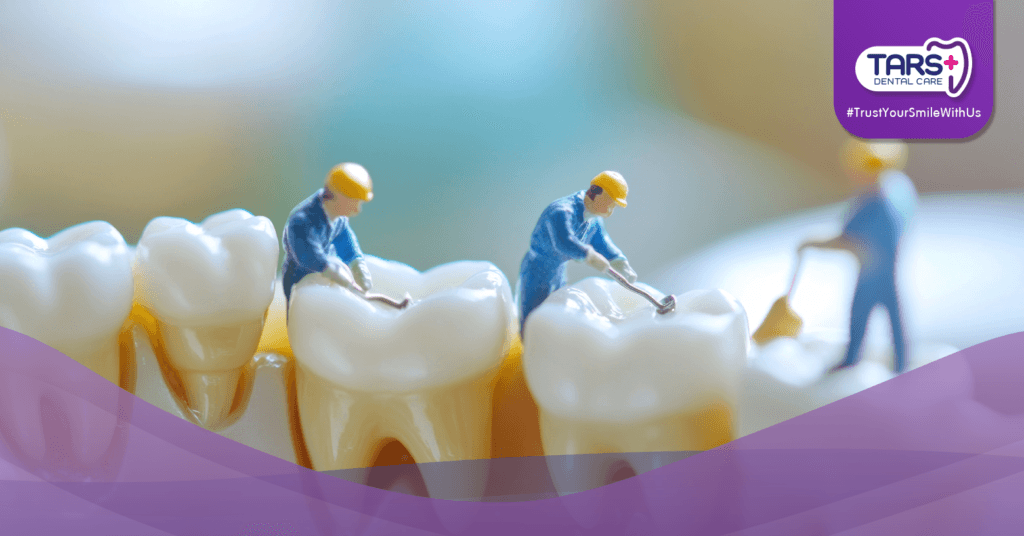 Biaya Tambal Gigi: Jenis, Faktor Penentu, dan Tips Memilih Klinik yang Tepat