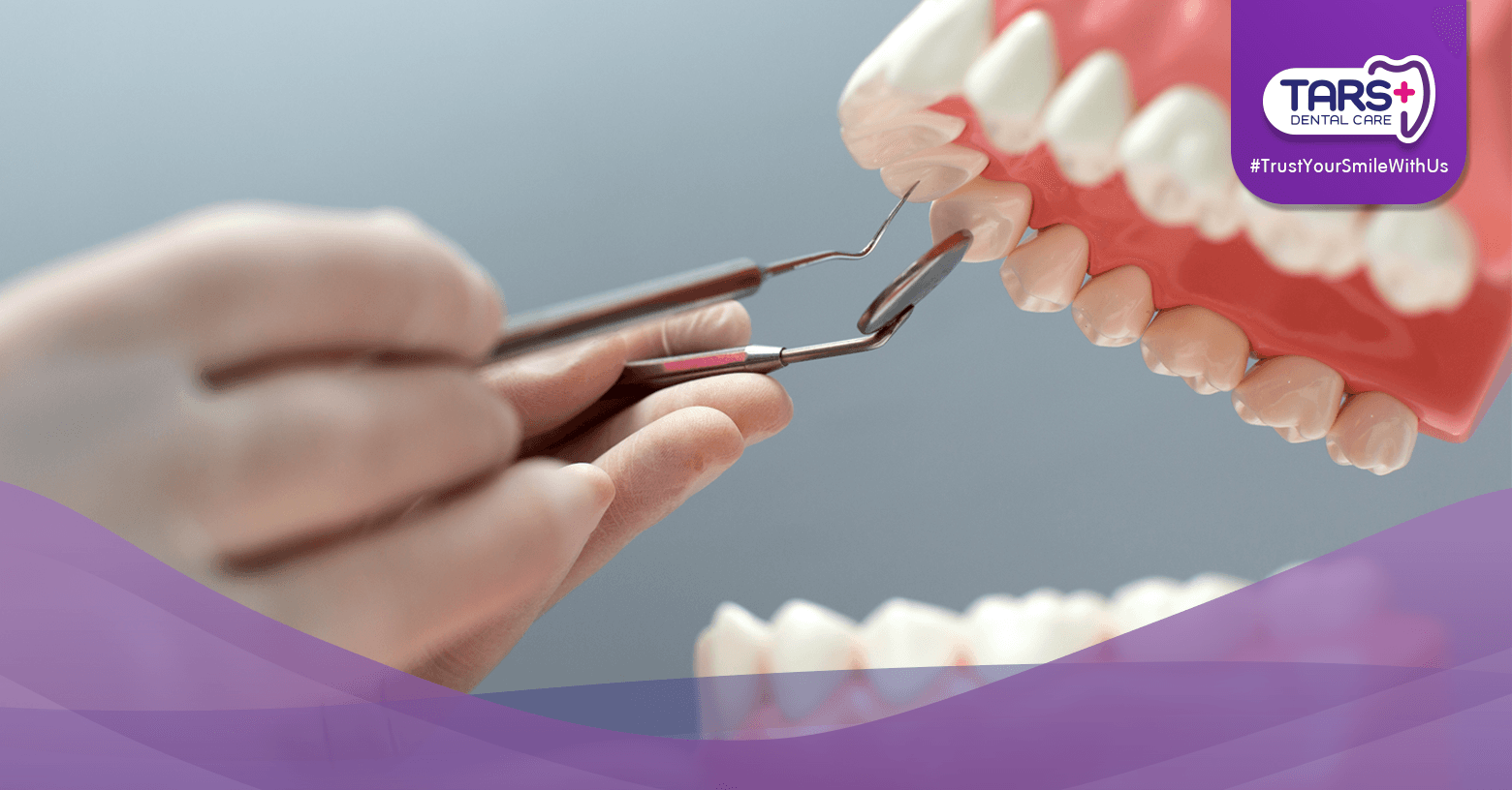 Gigi Tiruan: Panduan Memilih Gigi Palsu yang Tepat untuk Kebutuhanmu