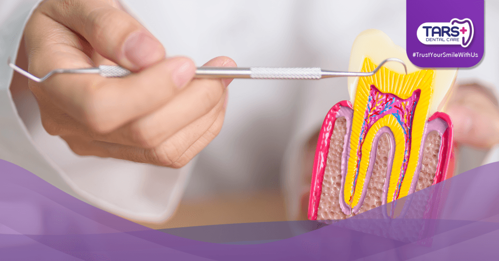 Tambal Gigi Permanen dan Tambal Gigi Sementara: Mana yang Tepat untuk Anda?