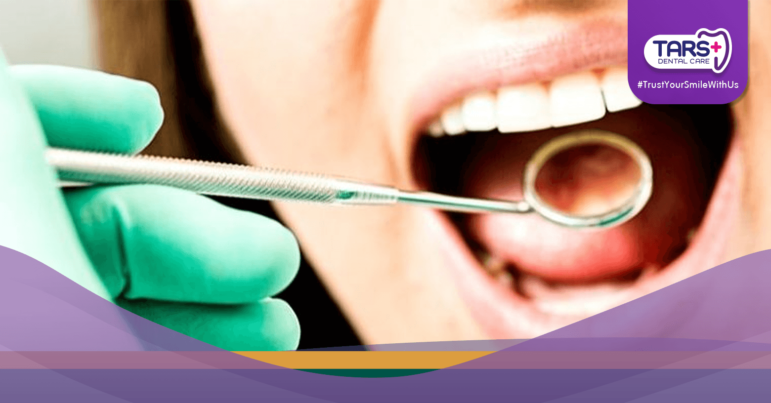 #16 Bolehkah Perawatan Gigi Saat Puasa Ini Fatwa MUI yang Perlu Kamu Tahu