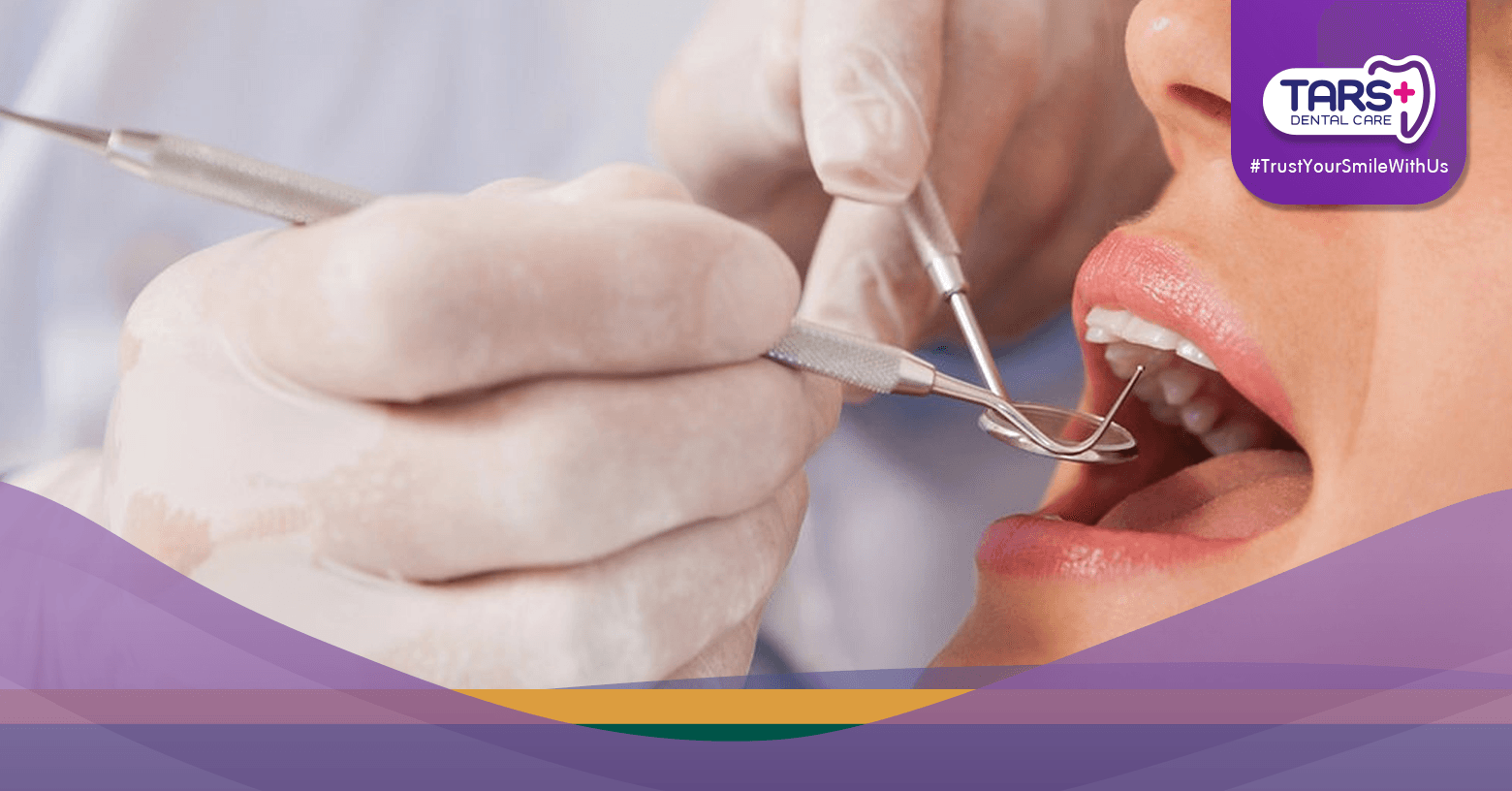 Scaling Gigi di Bulan Puasa, Apa Hukumnya Menurut Islam