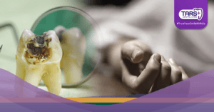 Meninggal Akibat Gigi Berlubang Ini Kisah Tragis yang Harus Jadi Pelajaran