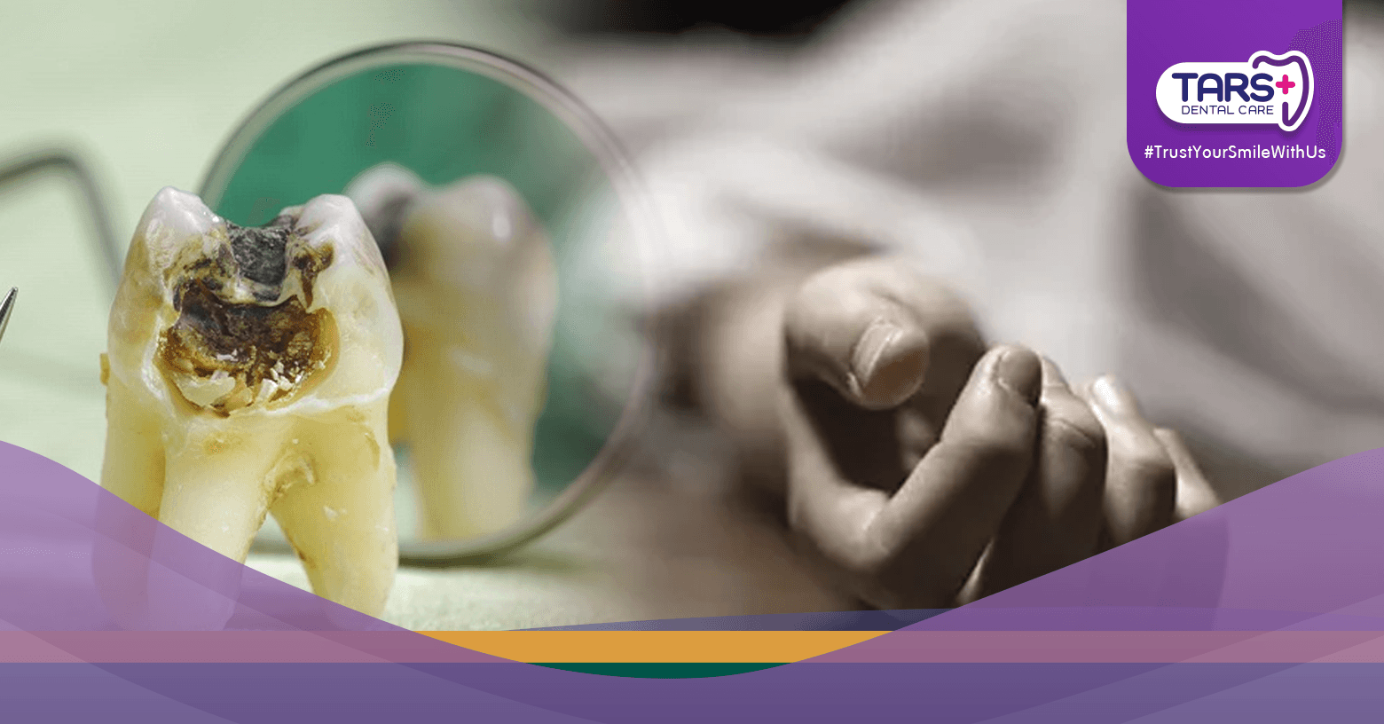 Meninggal Akibat Gigi Berlubang Ini Kisah Tragis yang Harus Jadi Pelajaran