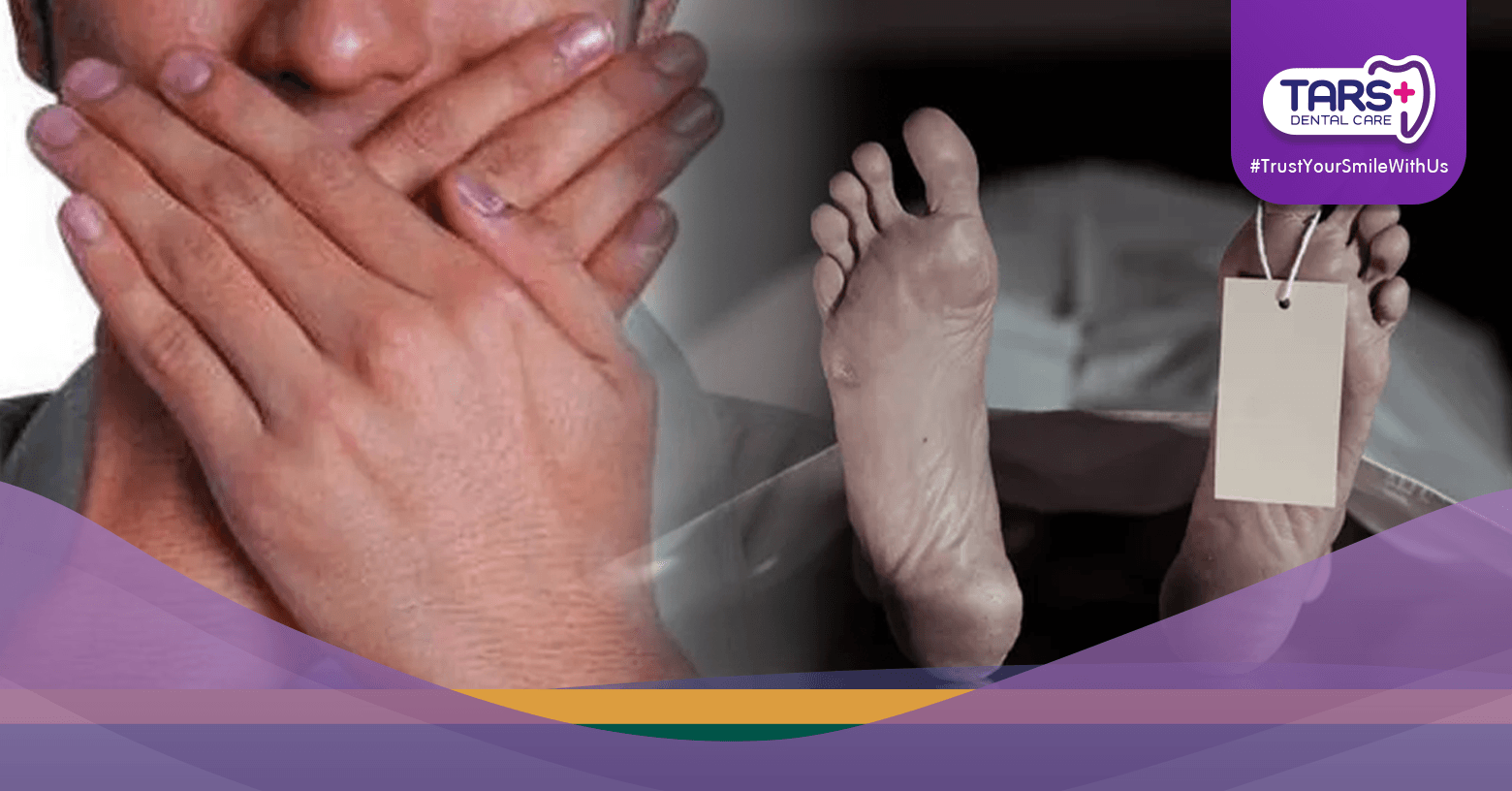 Gara-Gara Takut ke Dokter Gigi, Nyawa Seorang Pria Tak Tertolong