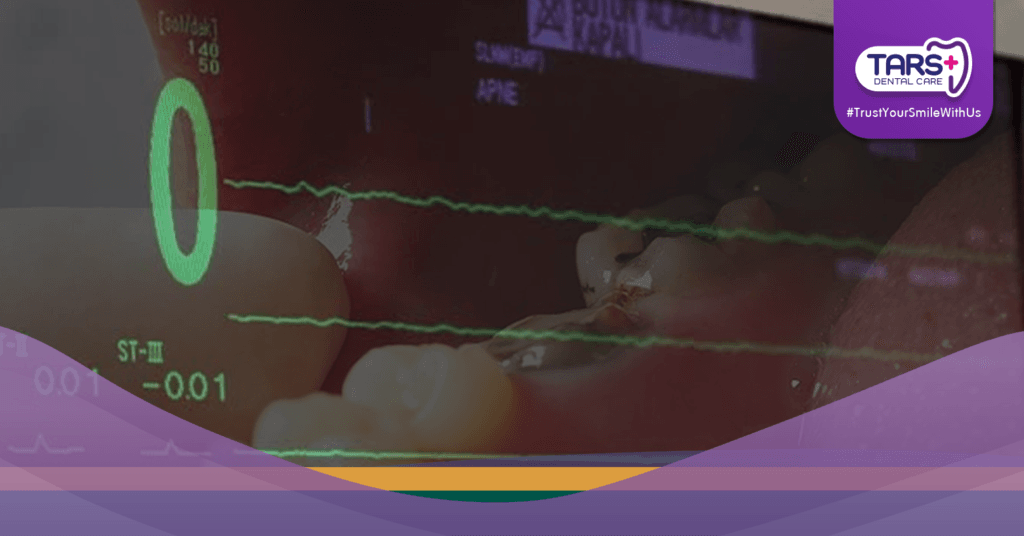 Meninggal Karena Gigi Berlubang Ini Fakta Medis di Baliknya dan Cara Mencegahnya