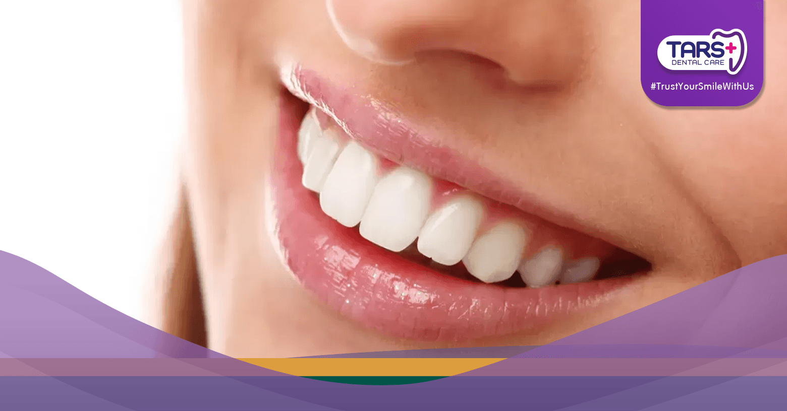 Gigi Tetap Putih dan Sehat Meski Puasa, Ini Rahasianya!