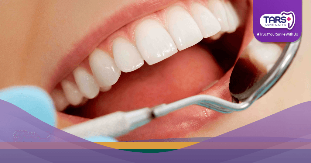 7 Kebiasaan Buruk yang Merusak Gigi Saat Puasa, Wajib Dihindari!