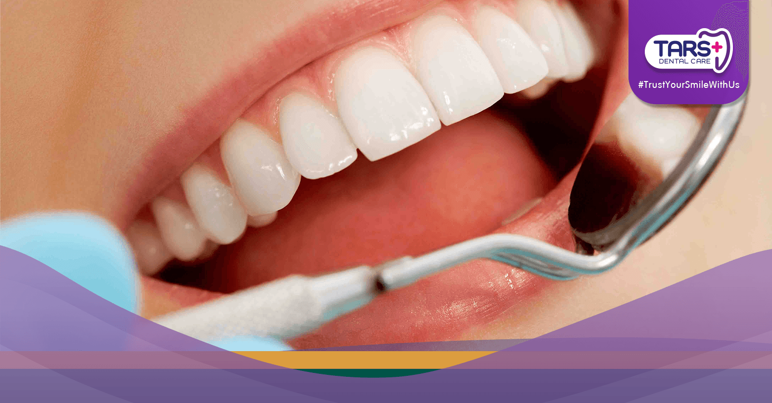 7 Kebiasaan Buruk yang Merusak Gigi Saat Puasa, Wajib Dihindari!