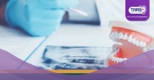 Wajib Tahu! Ini Efek Buruk Malas Periksa Gigi ke Dokter