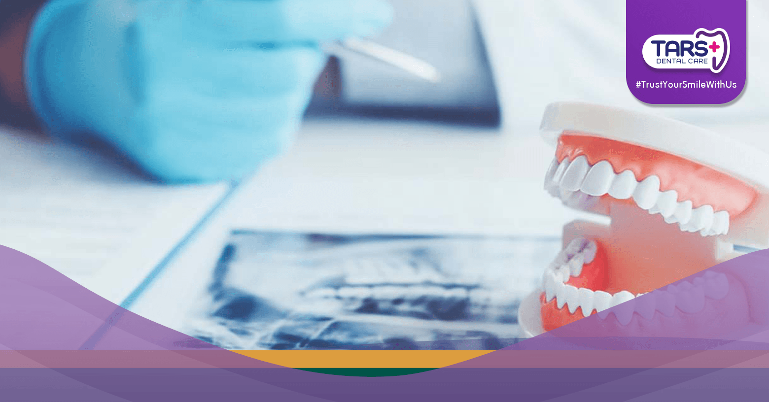 Wajib Tahu! Ini Efek Buruk Malas Periksa Gigi ke Dokter