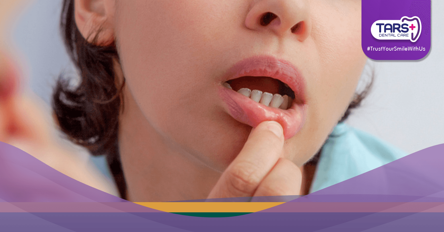 Fatwa MUI Sariawan & Obat Kumur Saat Puasa, Apa Hukumnya