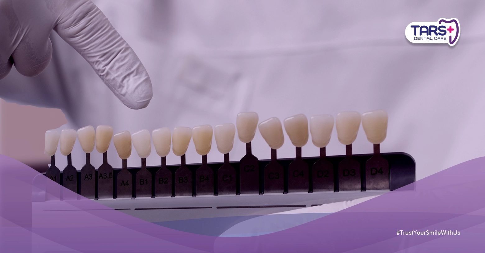 Bleaching dan Veneer: Biaya, Prosedur, Keunggulan, Kekurangan, dan Perawatan Setelahnya