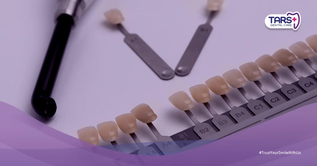 Cara Kerja Bleaching dan Veneer untuk Membuat Gigi Lebih Putih