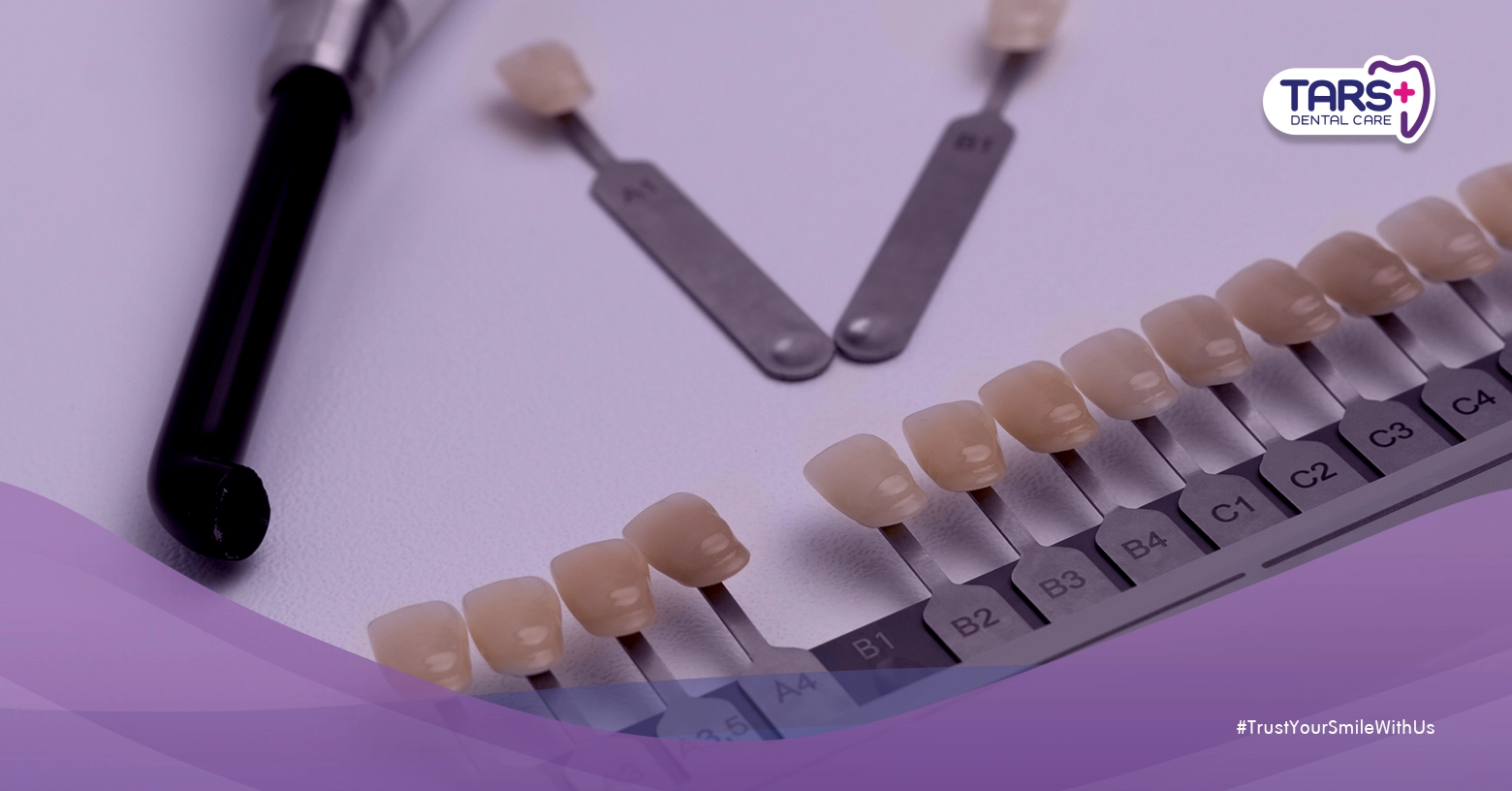 Cara Kerja Bleaching dan Veneer untuk Membuat Gigi Lebih Putih