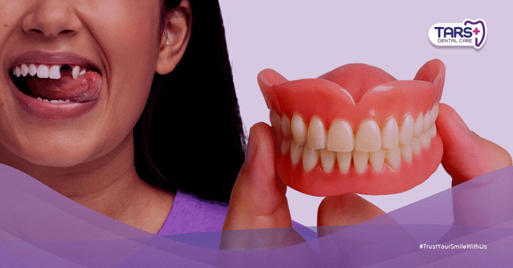 Mengenal Gigi Palsu Lepasan dan Cekat: Kelebihan dan Kekurangannya