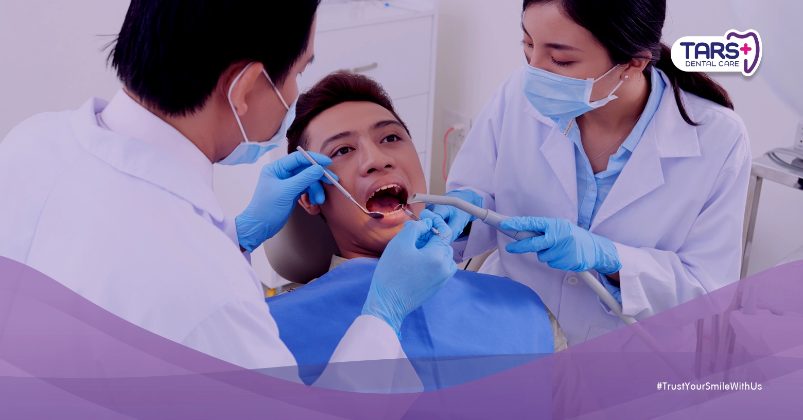 Tambal Gigi Depan atau Direct Veneer? Tips Memilih Perawatan Gigi Estetik yang Tepat