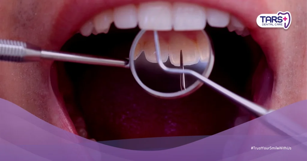 Kebiasaan yang Merusak Gigi: 5 Hal Sepele yang Sering Dilakukan Tanpa Sadar